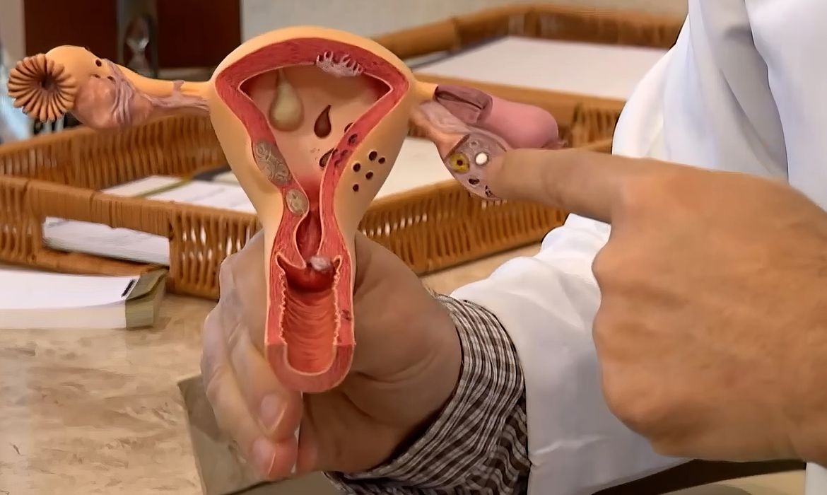 CNPq abre edital de R$ 60 milhões para pesquisas sobre endometriose